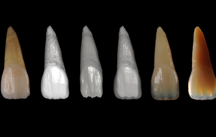 Herstellung von Zahnstrukturen mittels 3D-Druck