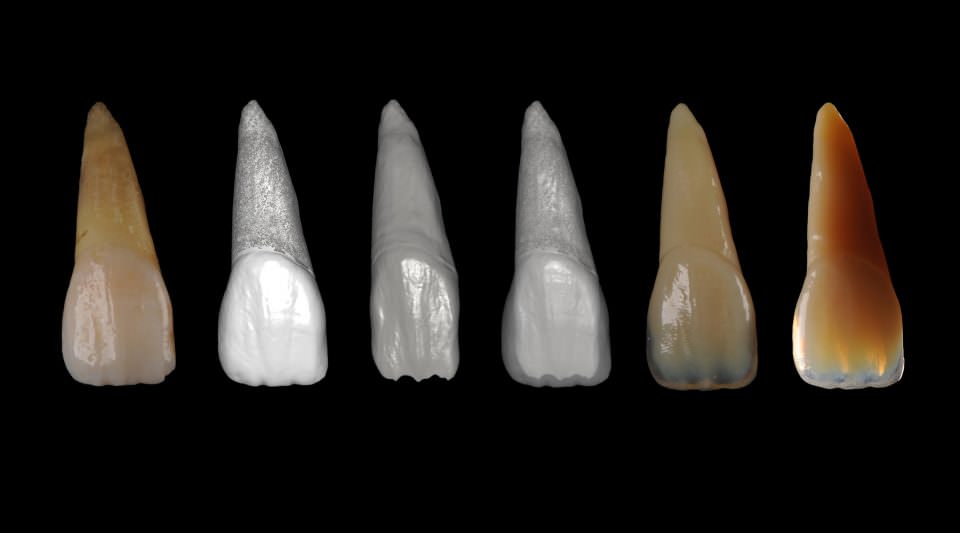 Herstellung von Zahnstrukturen mittels 3D-Druck