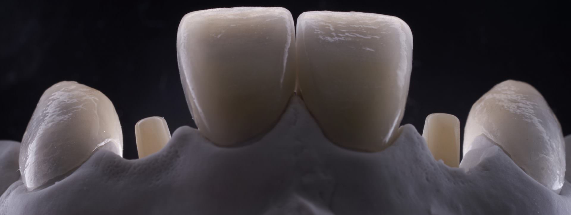 Zirconia Dental Implant by Straumann - Light Transmission