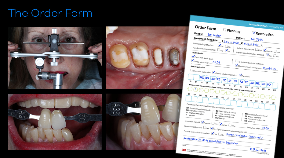 Das Bestellformular für die Zusammenarbeit zwischen Zahnärzte und Zahntechniker, Exemplarisch ausgefüllt und mit Patientenfotos