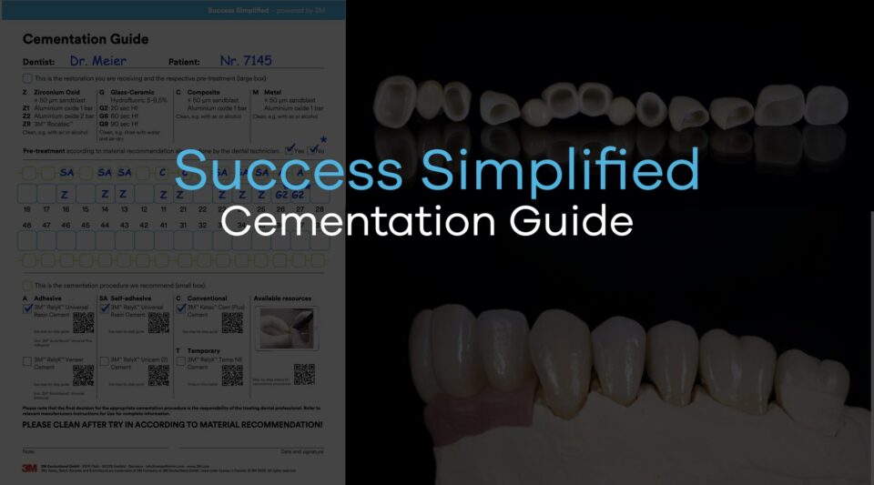 Artcile picture with the headline "Success Simplified Cementation Guide"
